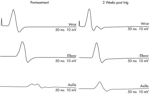 compound motor action potential Kindle Editon