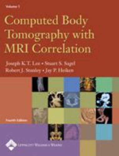 computed body tomography with mri correlation 2 volume set Reader