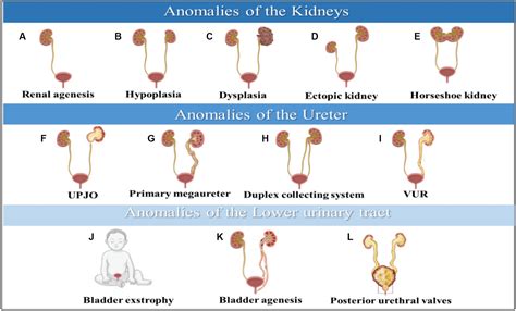 congenital anomalies of the urinary and genital tracts Kindle Editon