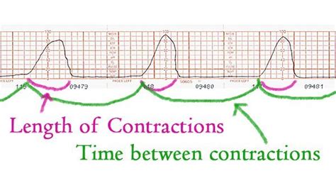 contractions 30 minutes apart how much longer