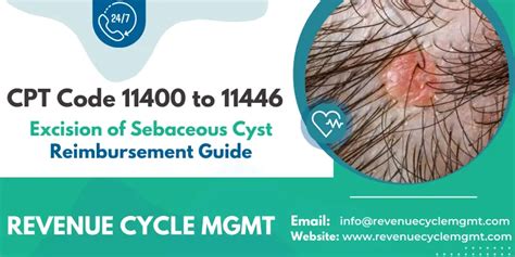 cpt code for excision of sebaceous cyst back Reader