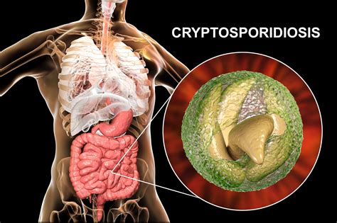 crypto parasite symptoms