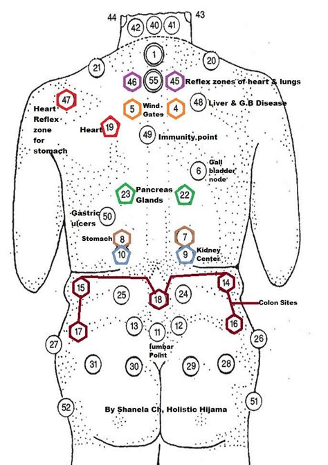 cupping therapy points chart Kindle Editon
