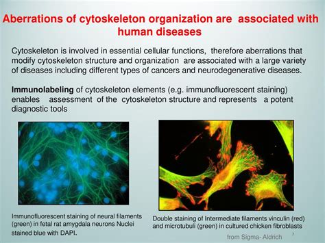 cytoskeleton and human disease cytoskeleton and human disease Reader