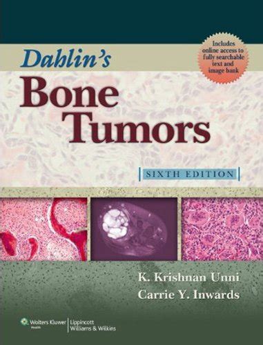 dahlins bone tumors general aspects and data on 10 165 cases Reader