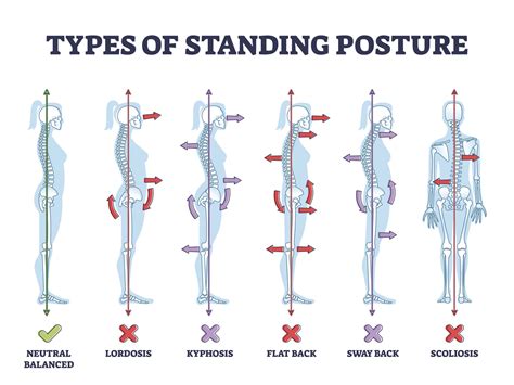 dance posture