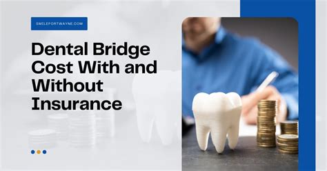 dental bridge cost with insurance