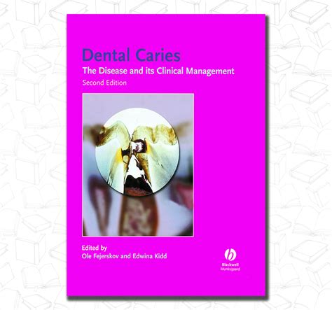 dental caries the disease and its clinical management PDF