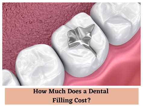 dental filling cost with insurance