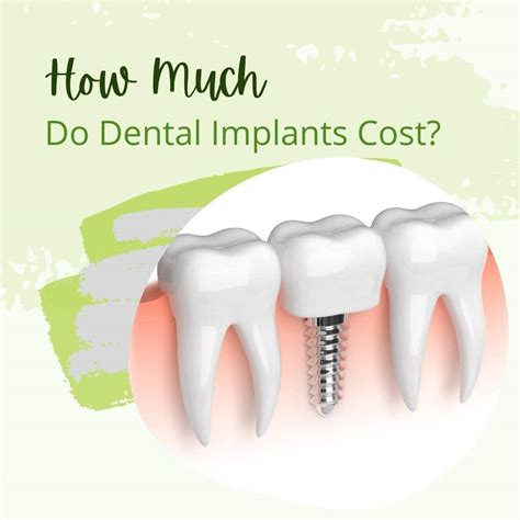 dental implants how much