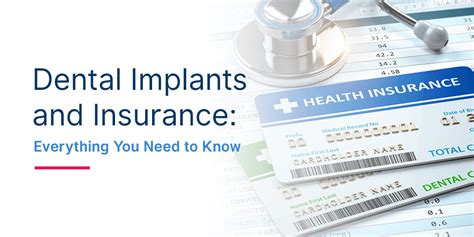 dental insurance for implants