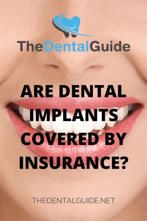 dental insurance implants