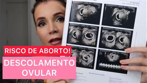 descolamento ovular