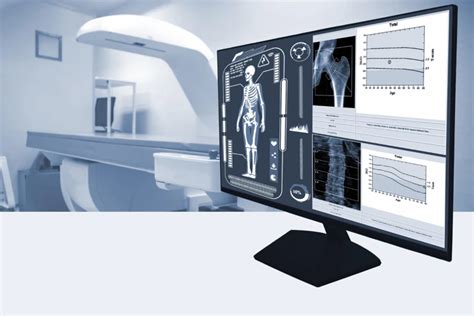 dexa scan singapore