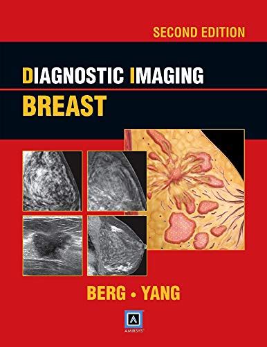 diagnostic imaging breast 2nd ed published by amirsys PDF