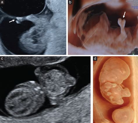diagnostic imaging of fetal anomalies Epub