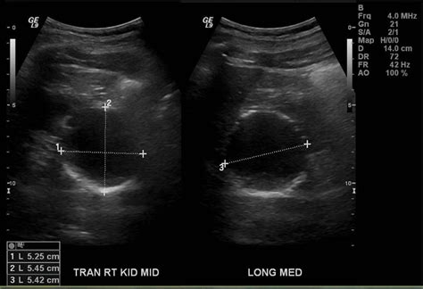 diagnostic ultrasound in urology and nephrology Reader