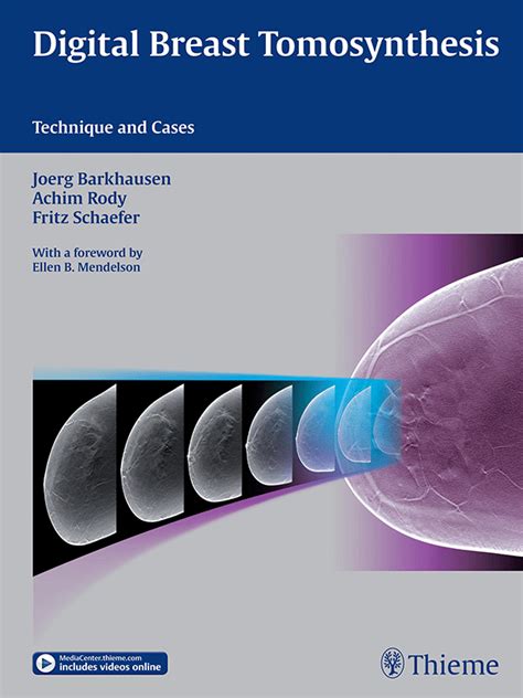 digital breast tomosynthesis technique cases Epub