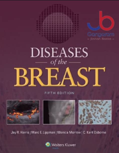 diseases of the breast 5e Epub