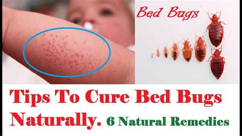 do it yourself bed bug treatment methods Reader
