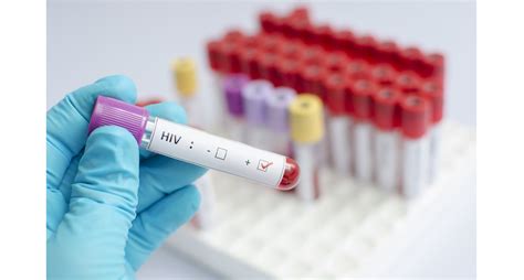 does hiv survive in dried blood