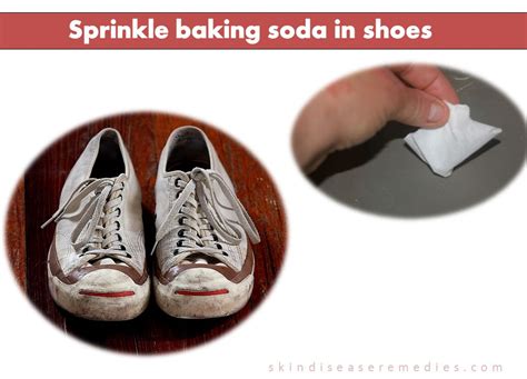 does hydrogen peroxide work for deodorizing shoes