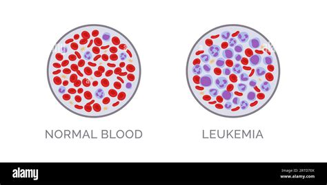 does normal blood work mean no cancer