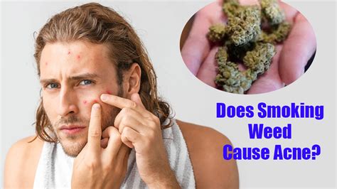 does weed cause acne