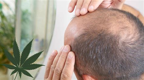 does weed cause hair loss