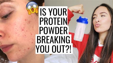 does whey protein cause acne