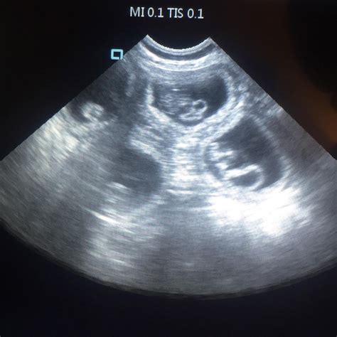 dog pregnancy scan at 4 weeks