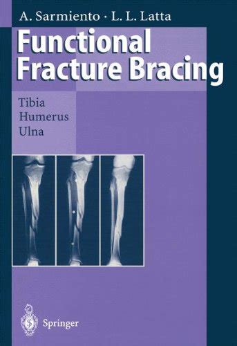download pdf functional fracture Reader