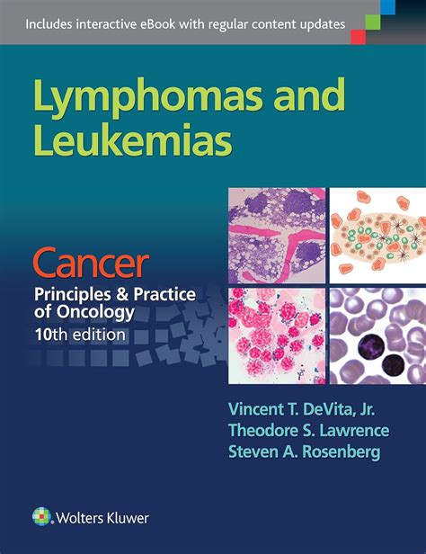 download pdf lymphomas leukemias principles practice oncology PDF