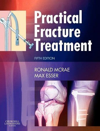 download practical fracture treatment 5e pdf PDF