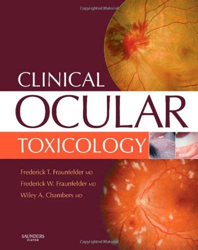 drug induced ocular side effects clinical ocular toxicology 7e Reader