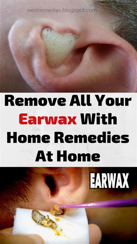 ear wax removal remedy at home