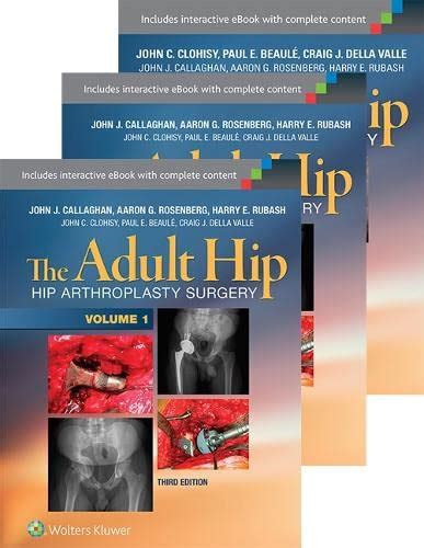 ebook online adult hip package arthroplasty alternatives Reader