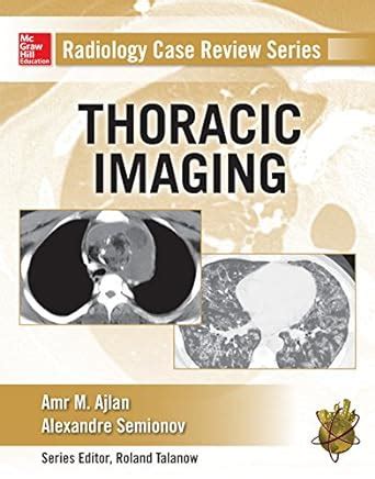 ebook radiology case review thoracic imaging Kindle Editon