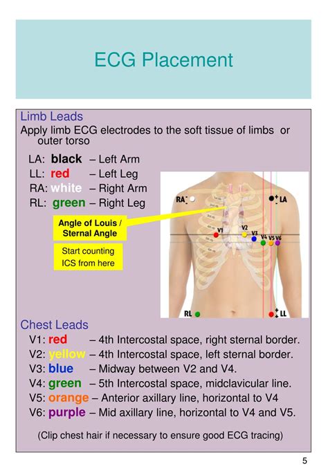 ecg replacement guide download Reader
