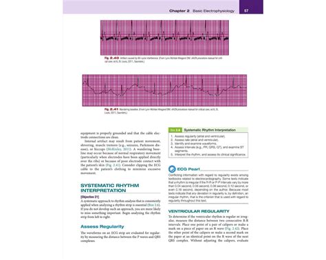 ecgs made easy book and pocket reference Doc