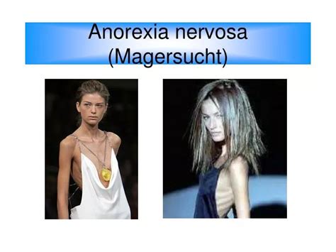 einflussfaktoren anorexia nervosa pr vention magersucht PDF