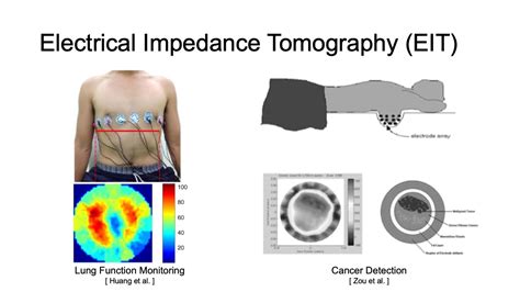 electrical impedance tomography electrical impedance tomography PDF