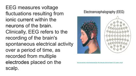 electro encephalography after removal of the occipital cortex Kindle Editon