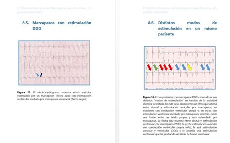 electrocardiograma marcapasos dummies posible entenderlo PDF