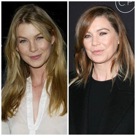 ellen pompeo plastic surgery