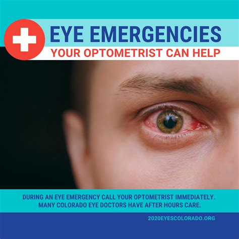 emergencies in eyecare emergencies in eyecare Epub