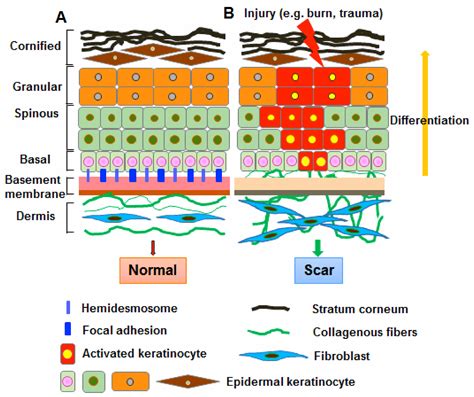 epidermal keratinocyte differentiation Doc