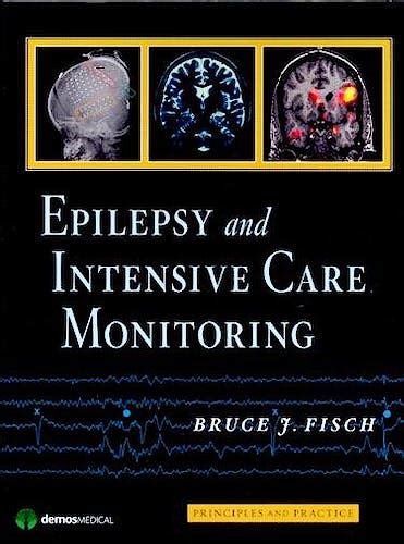 epilepsy and intensive care monitoring principles and practice PDF