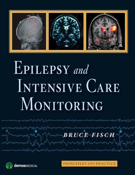 epilepsy and intensive care monitoring principles and practice PDF