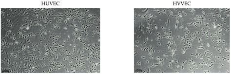 Eqtl Catalogue Endothelial Cells Huvec